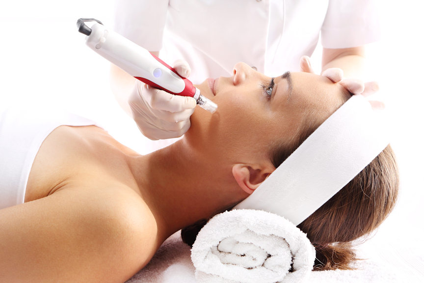 Microneedling Stuttgart